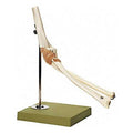 Elbow Joint Model L2851